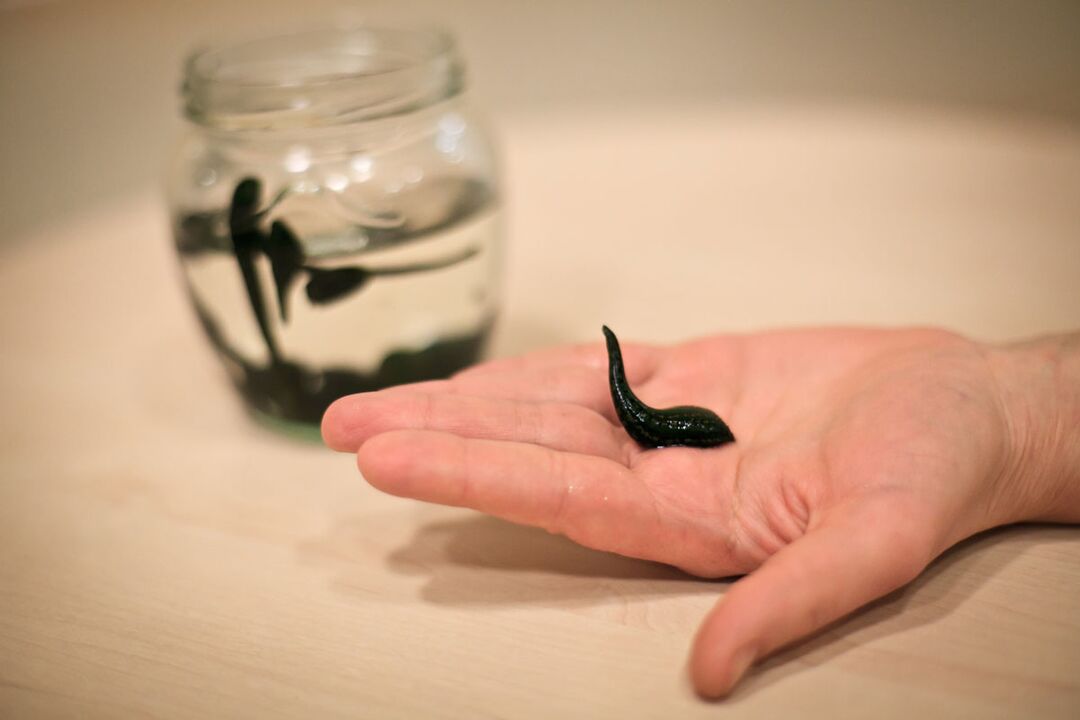 Leeches will be used as raw material for the production of penis growth stimulating cream